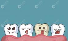 牙齿稀疏有缝隙是做矫正好还是贴面好?牙缝修复方法送给你