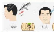 在广州植眉毛哪个机构比较好?公认好的医院有碧莲盛/大麦…
